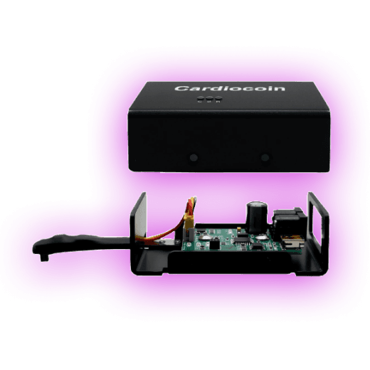 Smart pedal